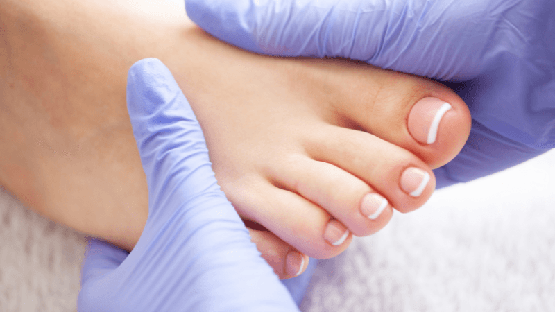 การทำเล็บเท้าในฤดูร้อนและฤดูหนาว: การดูแลเท้าเปลี่ยนแปลงไปอย่างไร